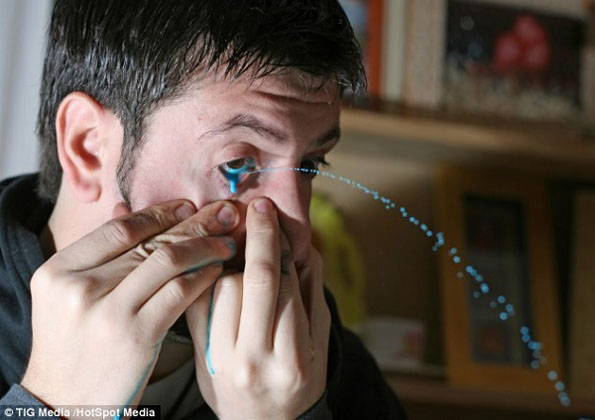 Artist Paints With Eye Squirts