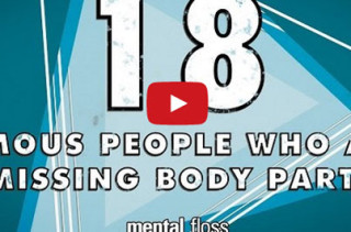 Interesting!: Famous People Missing Body Parts