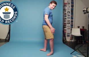 This Teen Can Bend His Feet Backwards And It Is CRAZY
