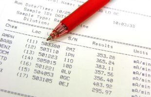 Tips for Coming Clean in A Surprise Drug Test