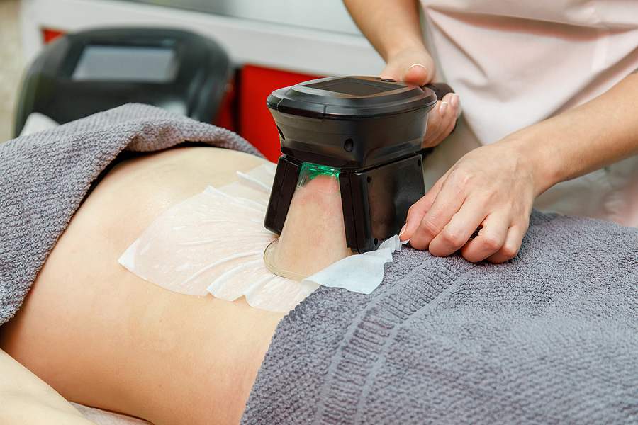 Best Areas to Tone With Coolsculpting Beauty Therapist Applying Cryolipolysis Treatment. Non-surgical