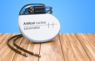 What Is Recovery Time from Pacemaker Surgery