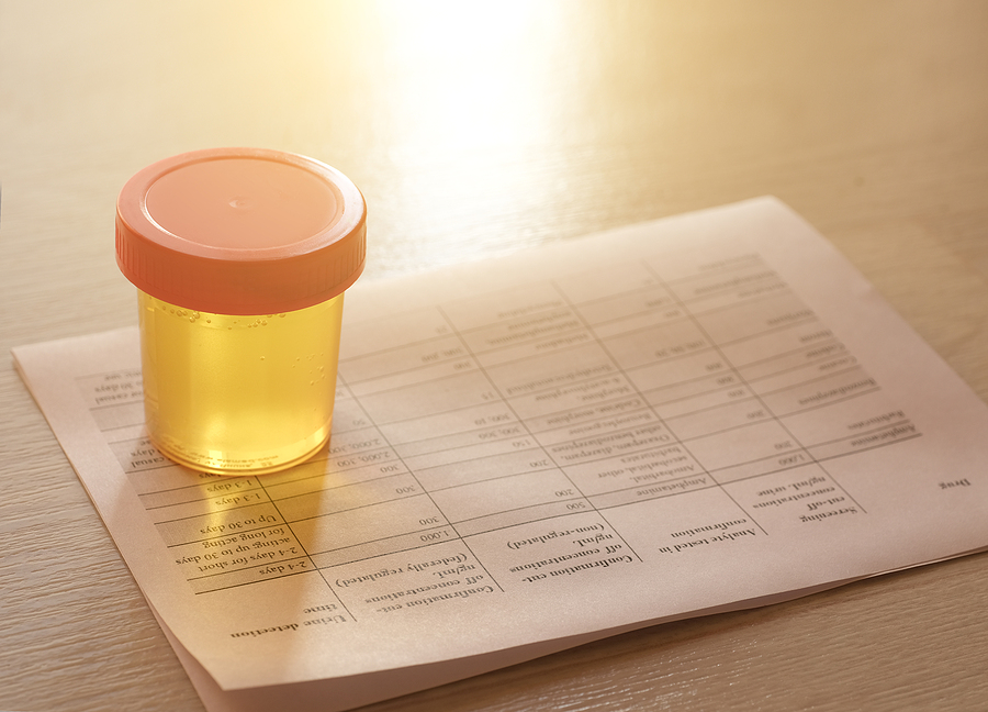 Everything You Need to Pass a Drug Test
