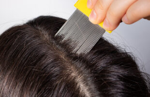 The Best At-Home Treatments for Menopausal Hair Thinning