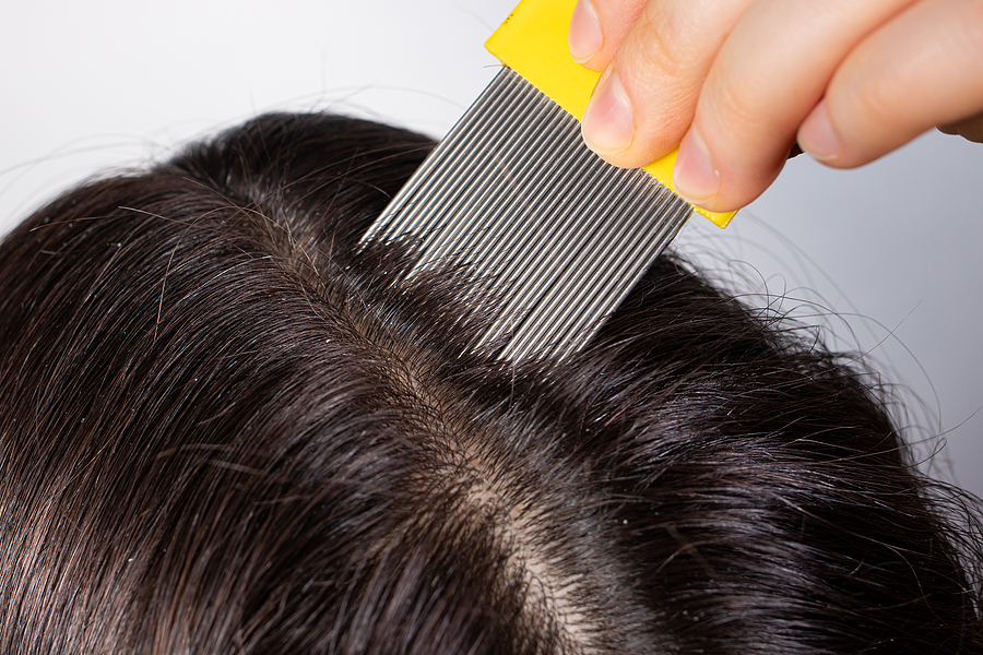 The Best At-Home Treatments for Menopausal Hair Thinning