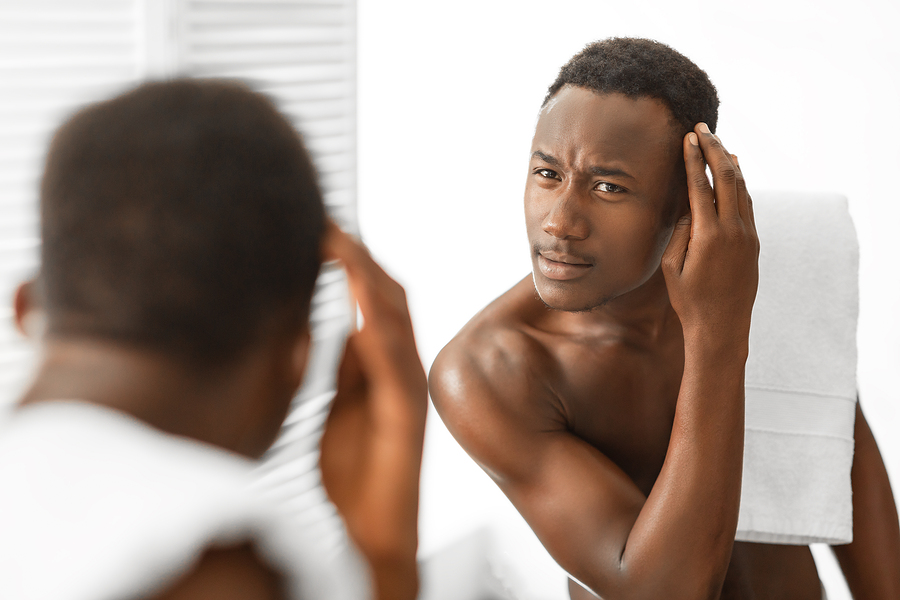 Hair Transplant for African American Hair Type