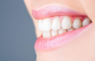 Boost Self Confidence With Proper Dental Health