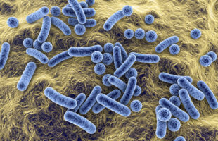 Why You Should Consider a Gut Bacteria Test for Better Wellness