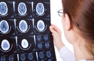 Common Causes of Washington Brain Injuries