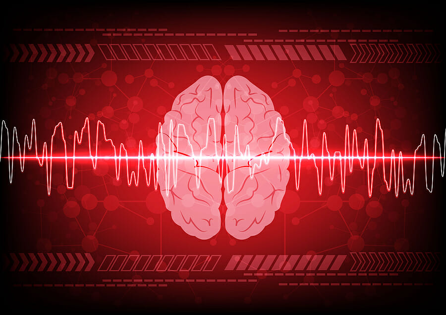 The “Comedown” Protocol: Why Your Brain Craves Loops After the Hype