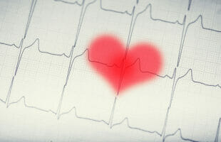 What Is The 30 Day Cardio Challenge?
