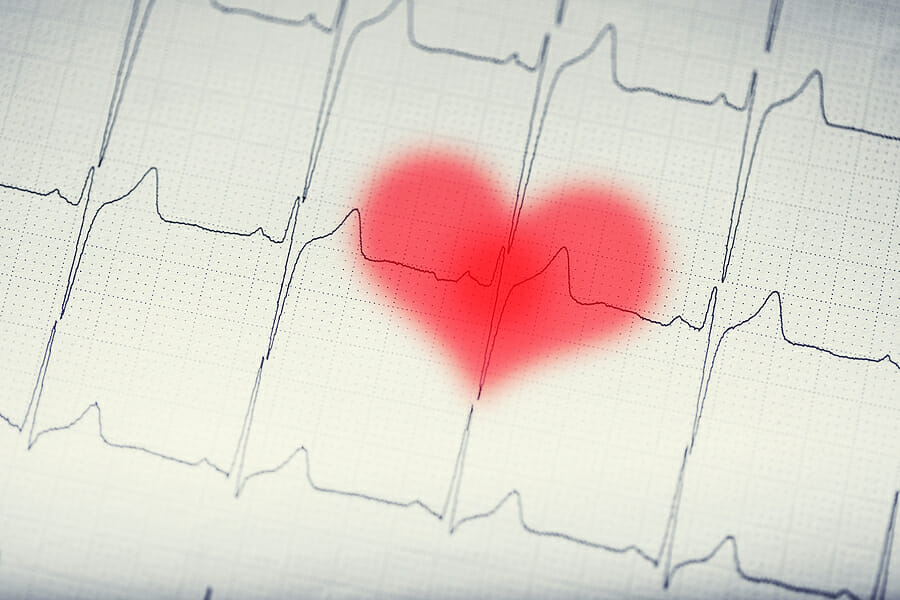 What Is The 30 Day Cardio Challenge?