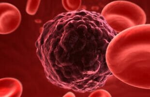 Who is at Risk for Mesothelioma?