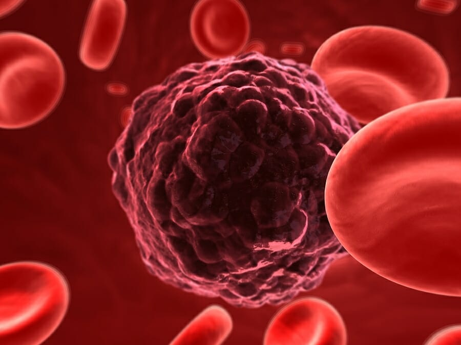 Who is at Risk for Mesothelioma?