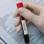 Vitamin Deficiency Anemia, A Quick Guide Doctor Holding Test Tube With Blood Sample And Label Anemia Over