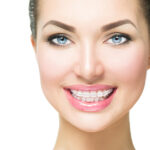 Braces. Beautiful Woman smile close up. Healthy Smile. Closeup C