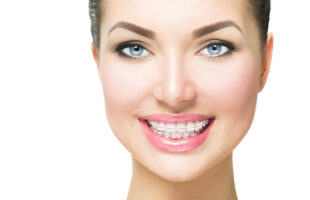 Top Benefits of Choosing Invisalign Over Traditional Braces