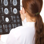 Brain Stem Injuries: Causes, Symptoms, and Treatment Female Doctor