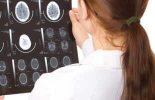 Brain Stem Injuries: Causes, Symptoms, and Treatment   