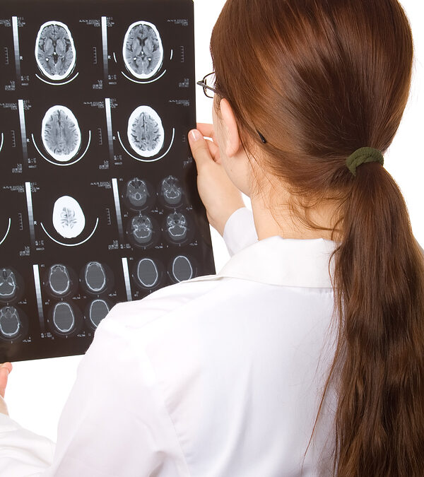 Brain Stem Injuries: Causes, Symptoms, and Treatment   