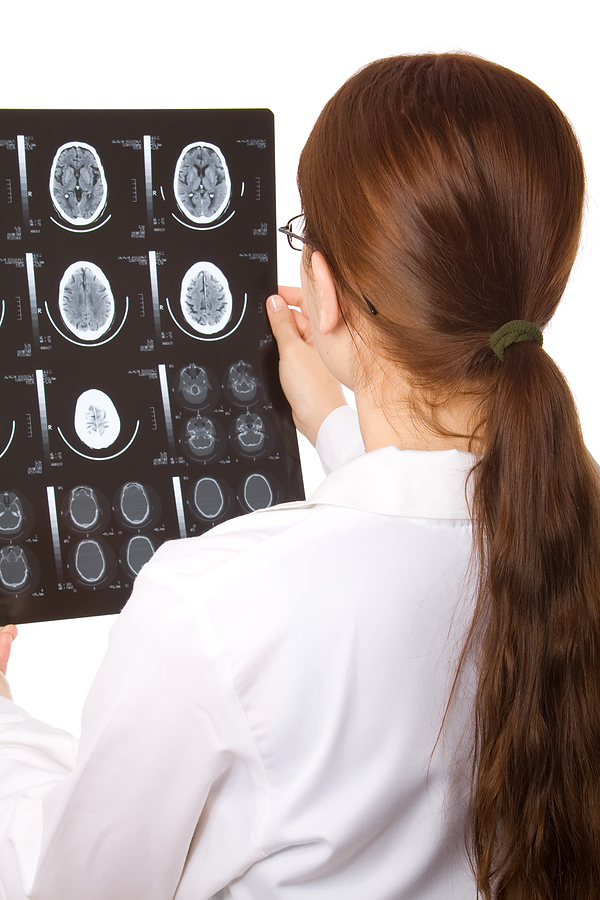 Brain Stem Injuries: Causes, Symptoms, and Treatment
